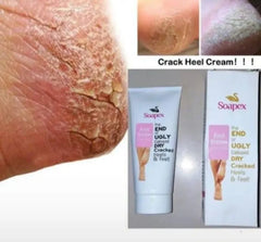 Soapex Heel Cream