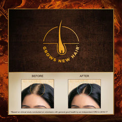 Indulekha Bringha Hair Oil - 100ml
