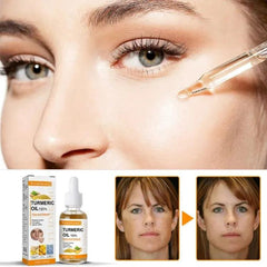 Turmeric Remove Dark Spots Essential Oil