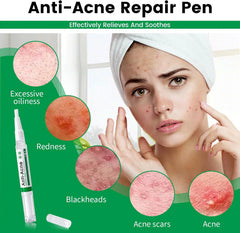 SADOER Tea tree Anti-Acne Repair Pen - 2ml
