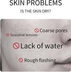 Oyax Rice Whitening and Brightening Facial Mask - 10 PCS