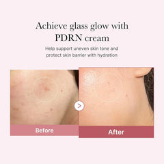 Medicube PDRN Pink Hyaluronic Moisturizing Cream - 50ml