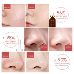 MUICIN - Shrink Pores Hyaluronic Acid Serum - 30ml