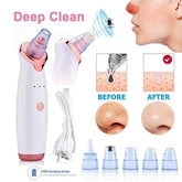 5β―inβ―1 Multiβfunctional Black Head Removal Machine