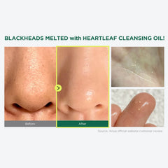 Anua Heartleaf Pore Control Cleansing Oil - 200ml