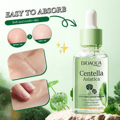 Bioaqua Centella Asiatica Soothing Repair Anti Acne Face Serum Essence - 30ml