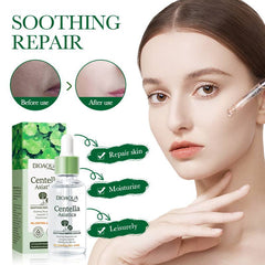 Bioaqua Centella Asiatica Soothing Repair Anti Acne Face Serum Essence - 30ml