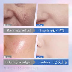 Sadoer Brightening Gentle Oil Control Refreshing Cleanser - 100g