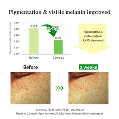 Dr.Althea Gentle Vitamin C Serum - 30ml