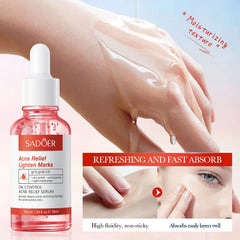 Sadoer Acne Relief Face Serum - 30ml