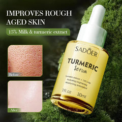 Sadoer Turmeric Serum - 30ml