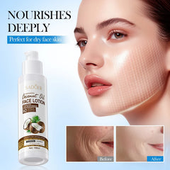 SADOER Nourishing Coconut Oil Moisturize Face Lotion - 100ml