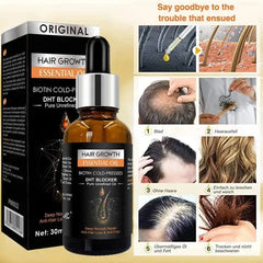 Hair Growth Essential Oil – Biotin Cold-Pressed DHT Blocker – 30ml (Anti Hair Loss)