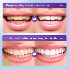 Sadoer V34 Remove Yellow Teeth Stains Whitening Toothpaste – 28 ml