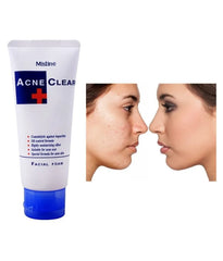 Mistine Acne Clear Facial Foam - 85ml