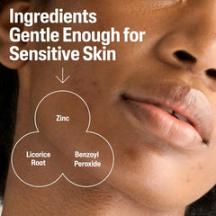 Cetaphil Gentle Clear Acne Cleanser - 124ml