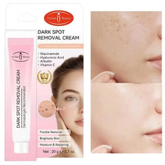 Aichun Beauty Dark Spot Removal Cream - Each