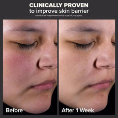 Paula’s Choice Skin Perfecting 2% BHA Liquid Exfoliant - 118ml