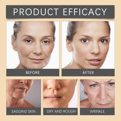 Ouhoe Botox Bee Venom Whitening & Moisturizing Facial Cream - 20g