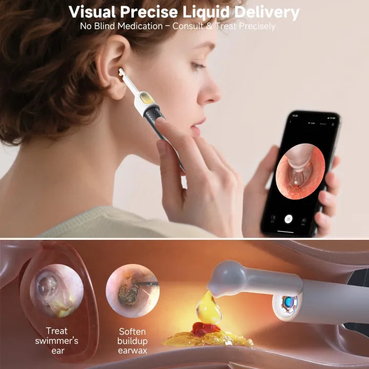 Smart Visual Ear Wax Cleaning Kit – Wireless HD Camera Ear Cleaner