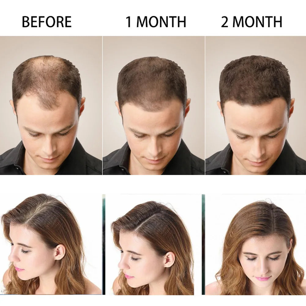 Disaar Hair Shampoo Anti-Hair Loss - 200ml