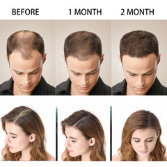 Disaar Hair Shampoo Anti-Hair Loss - 200ml