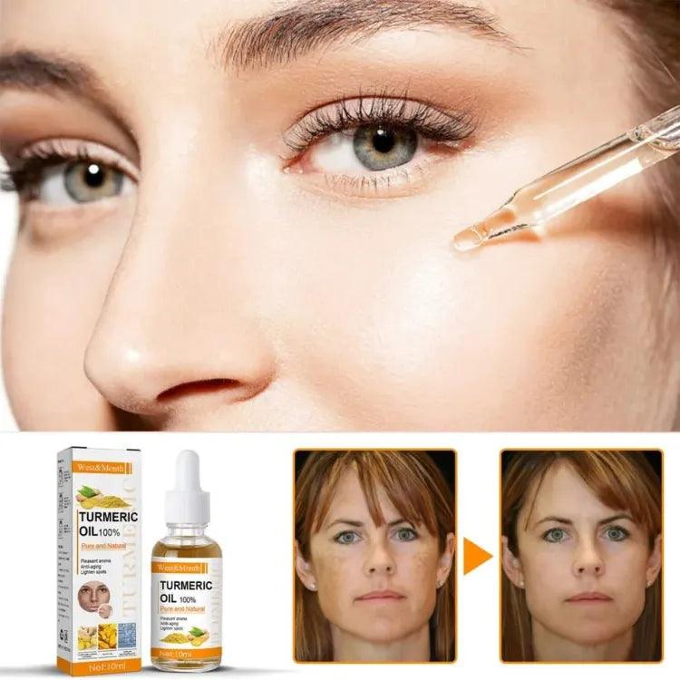 Turmeric Remove Dark Spots Essential Oil