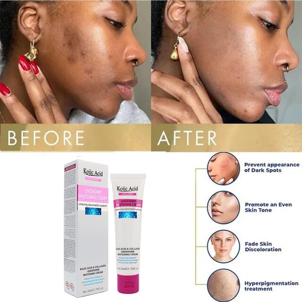 Guanjing Kojic Acid & Collagen Underarm Whitening Cream – 50ml