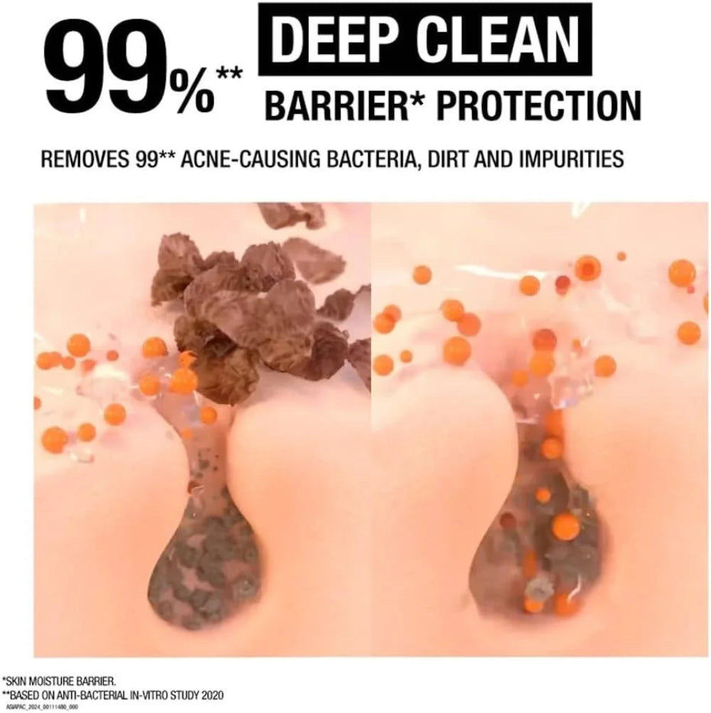 Neutrogena Deep Clean Acne Foaming Cleanser - 100g