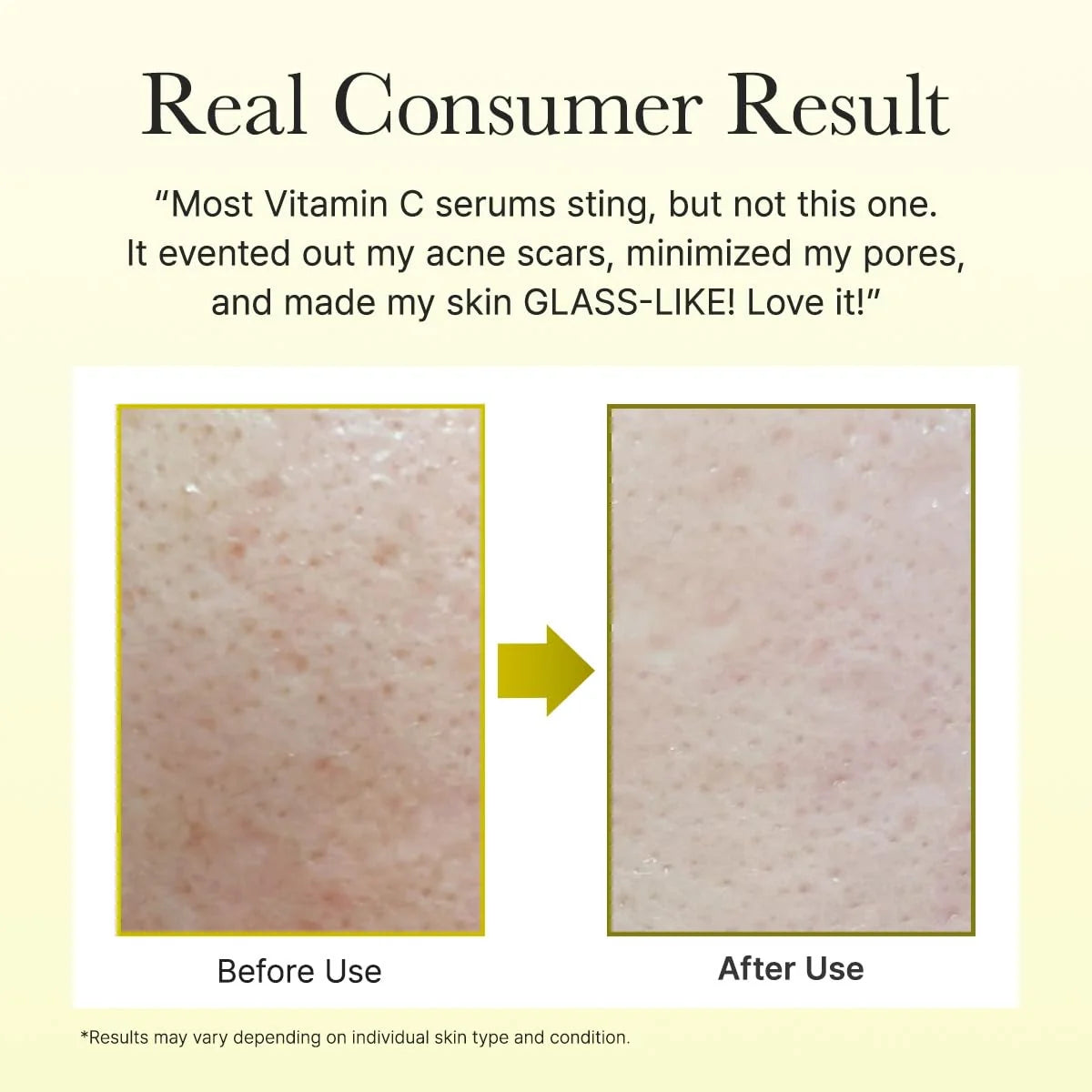 Arencia Vitamin C Booster Shot Serum for Dark Spot Care - 30ml