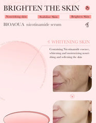BIOAQUA Dispel Frekle Stable Soothing Nicotinamide Serum- 30ml