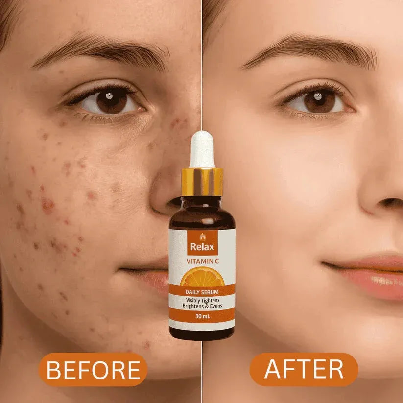 Relax Vitamin C Daily Serum For Bright and Healthy Skin - 30ml