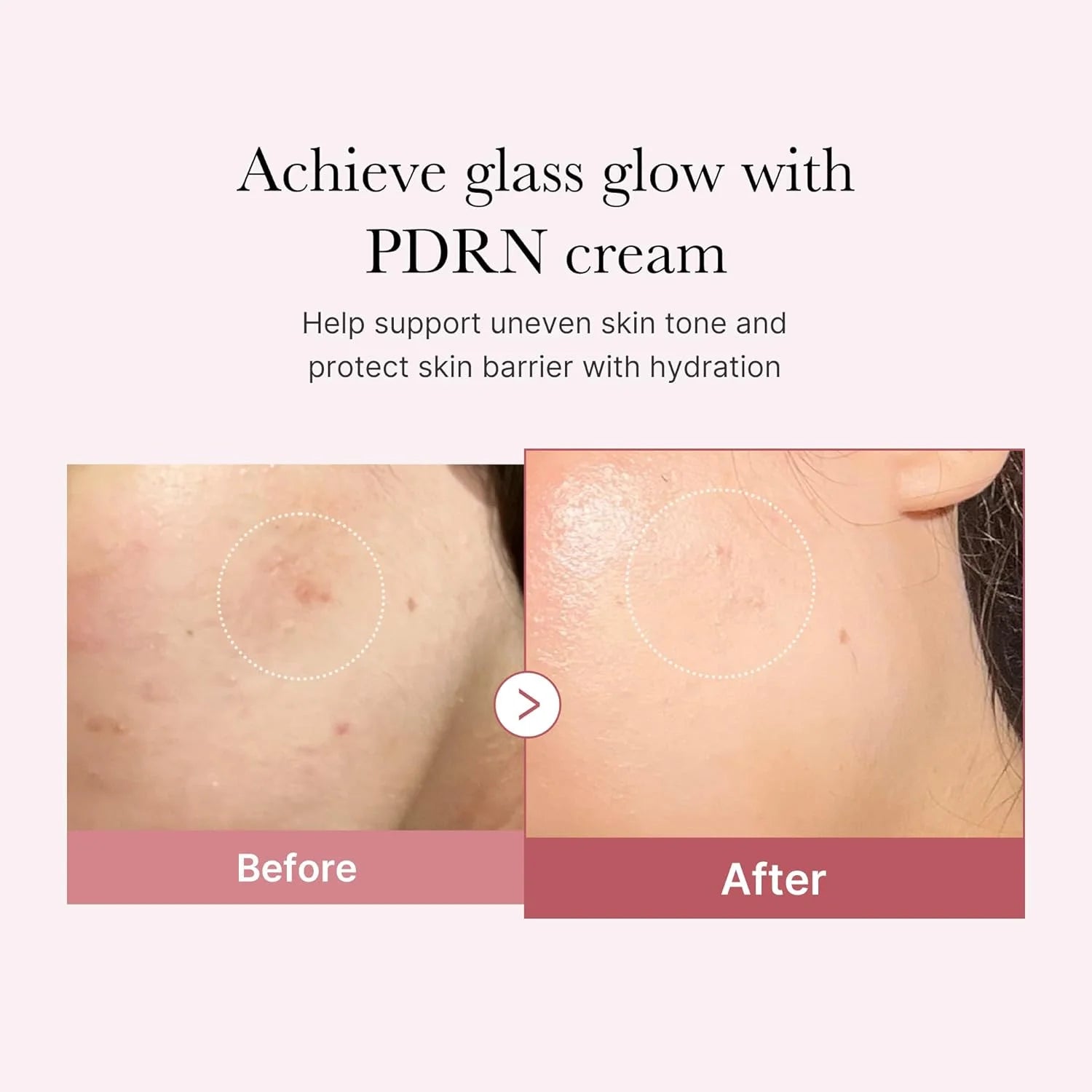 Medicube PDRN Pink Hyaluronic Moisturizing Cream - 50ml
