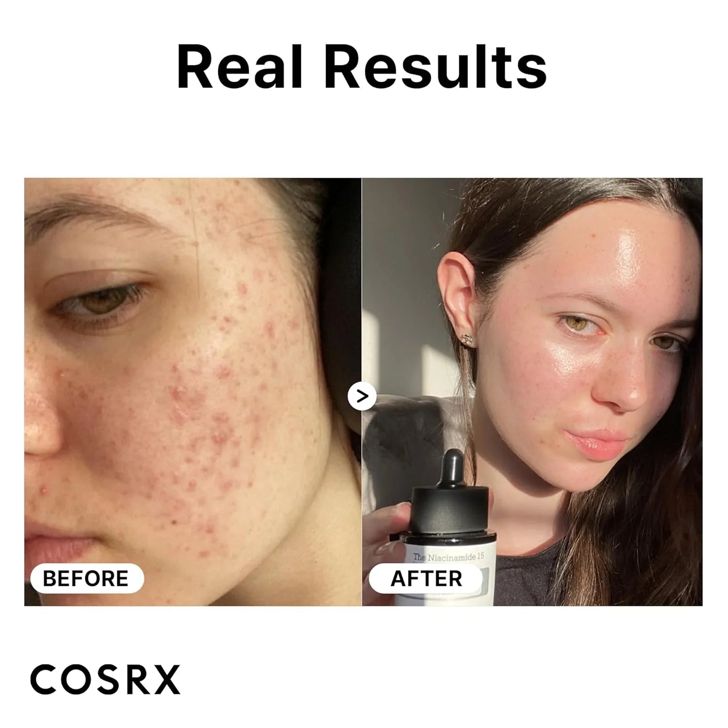 COSRX Niacinamide 15% Face Serum - 20ml