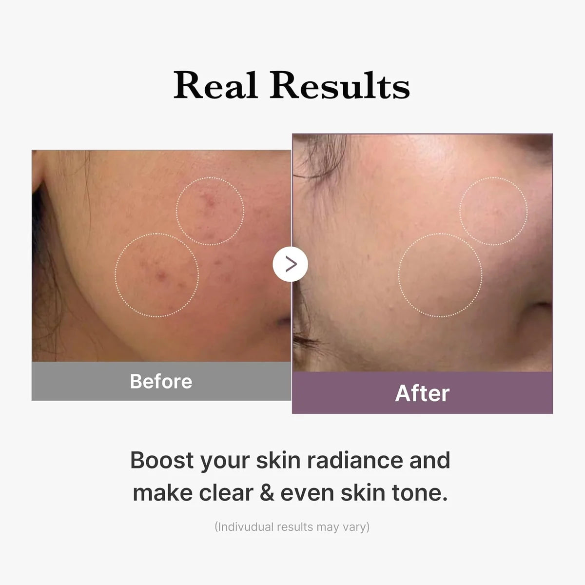 Medicube - AGE-R Glutathione Glow Toner - 140ml