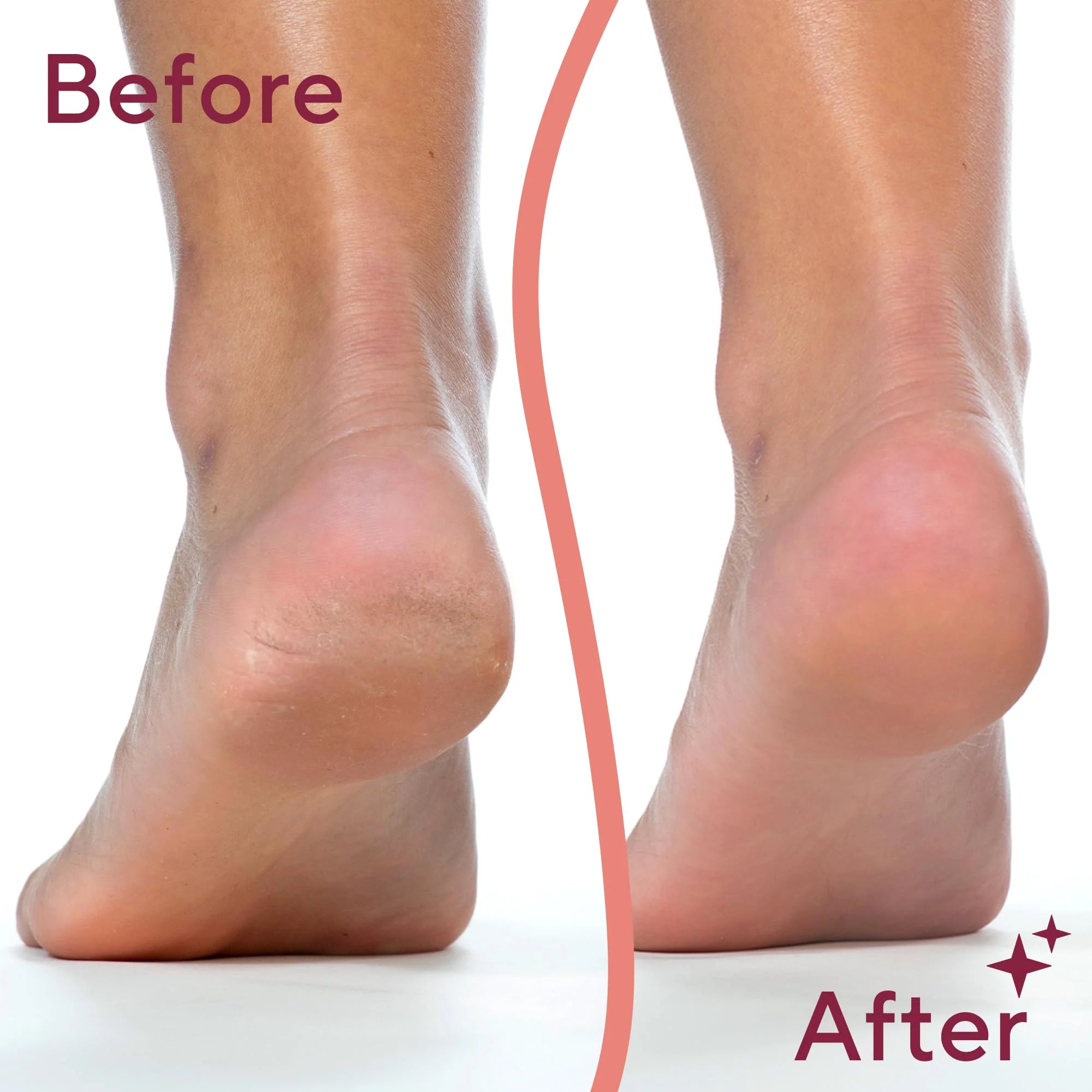 Flawless Pedi electronic pedicure tool