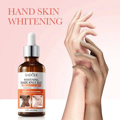 Sadoer Dark Knuckle Whitening Niacinamide Vitamin C Body Serum - 50ml
