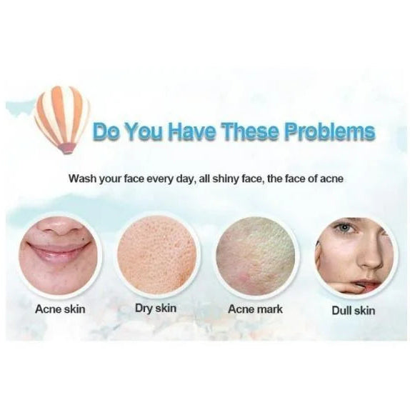 Bioaqua Acne Removal Cream Spot-Free Skin