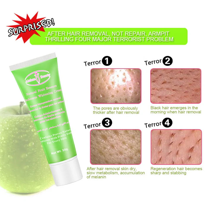 AICHUN BEAUTY Private Parts ,Underarm Glowing Body Care Cream - 50g