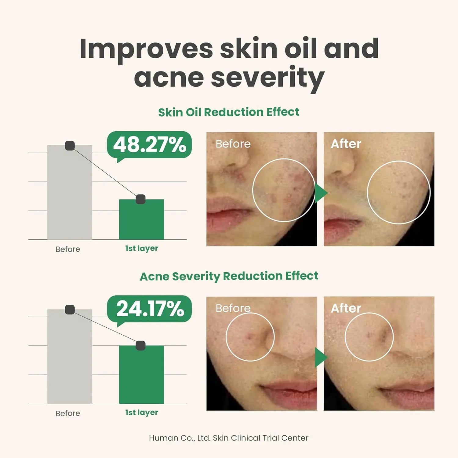 AXIS-Y The Spot Difference Blemish Treatment Serum - 15ml