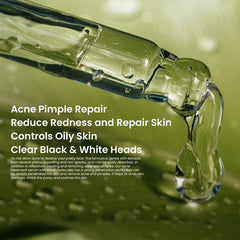 Rivaj Acne Treatment Serum - 30ml