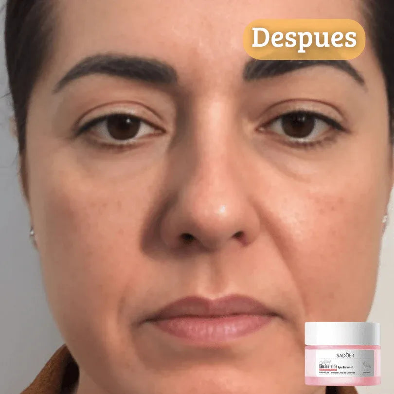 Sadoer Niacinamode Spot Remover Repair Cream 50g