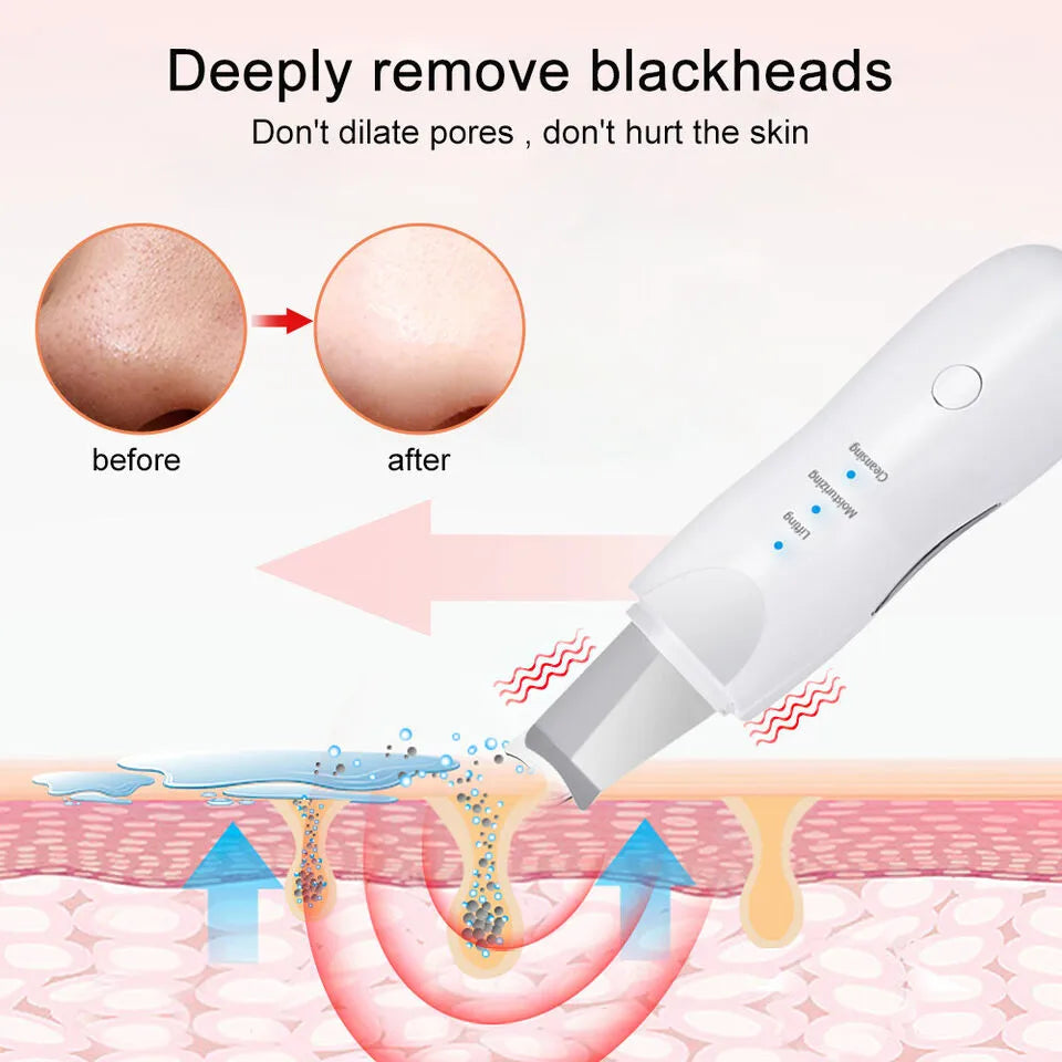 Face Scrubber Machine For Blackhead