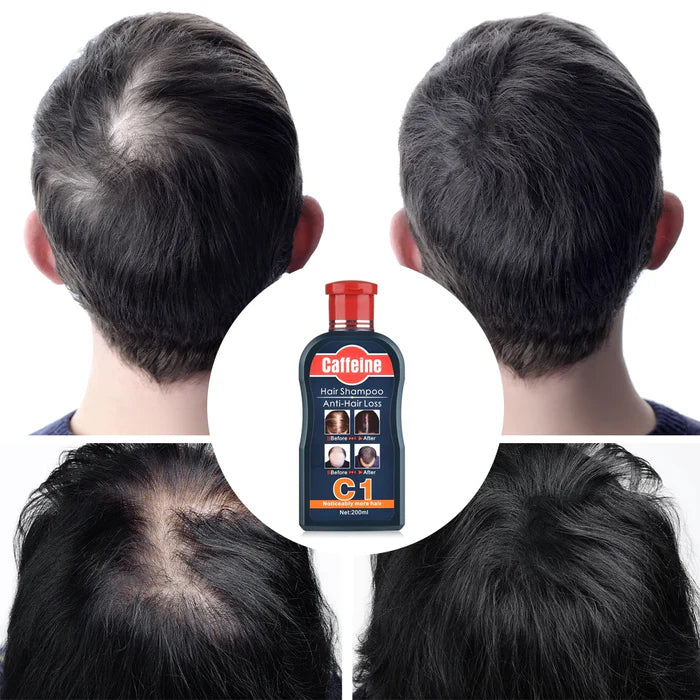 Pei Mei Caffeine Hair Shampoo Anti-Hair Loss - 200ml
