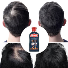Pei Mei Caffeine Hair Shampoo Anti-Hair Loss - 200ml