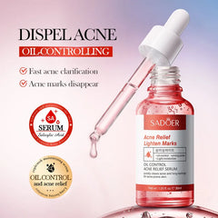 Sadoer Acne Relief Face Serum - 30ml
