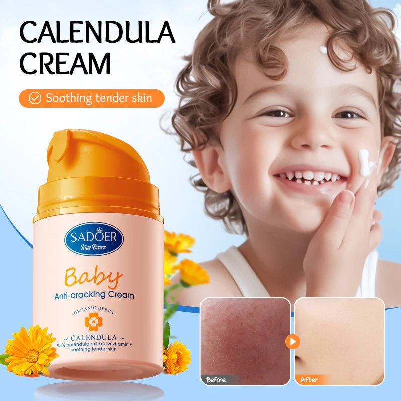 SADOER Baby Calendula Vitamin E Gentle Soothing Anti-Repair Cream - 50g