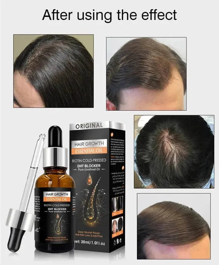 Hair Growth Essential Oil – Biotin Cold-Pressed DHT Blocker – 30ml (Anti Hair Loss)