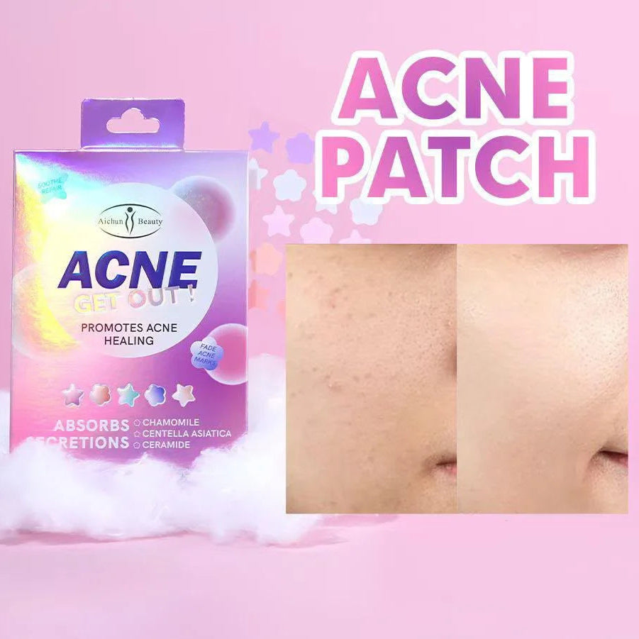 Aichun Beauty Acne Get Out! Patches - Each