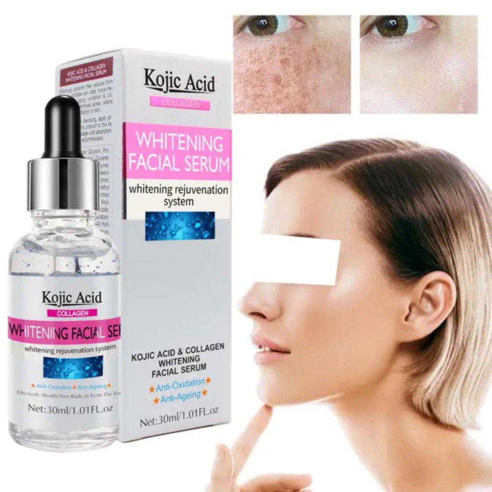 Kojic Acid Whitening Facial Serum - 30ml